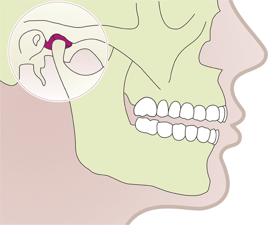 articulación-temporo-mandibular